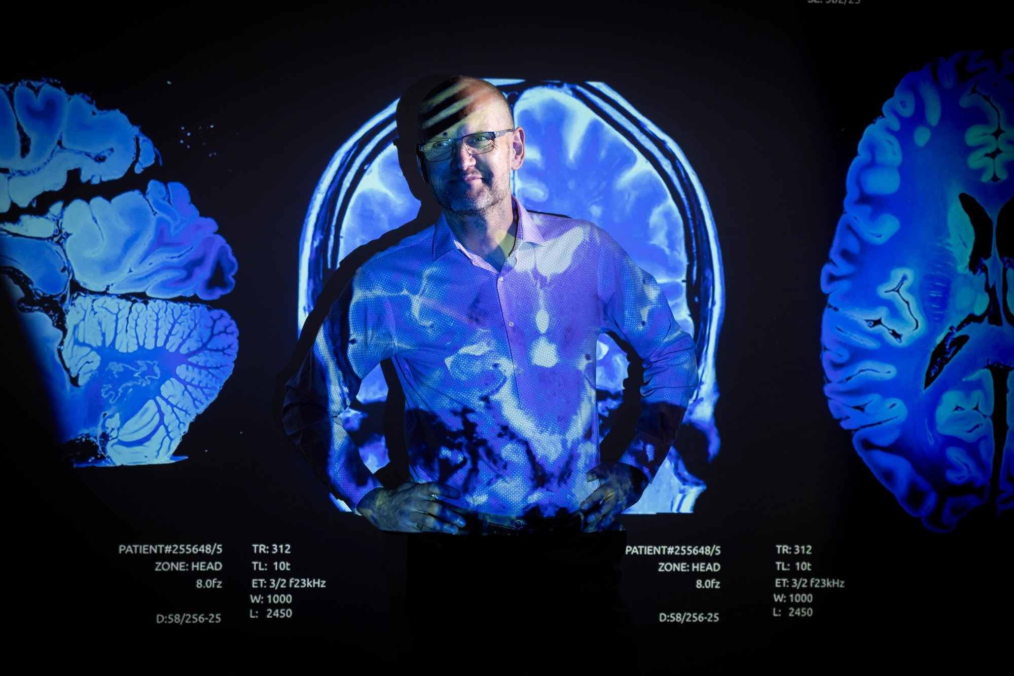 Axel_Martin_Brain_Scan_Projection