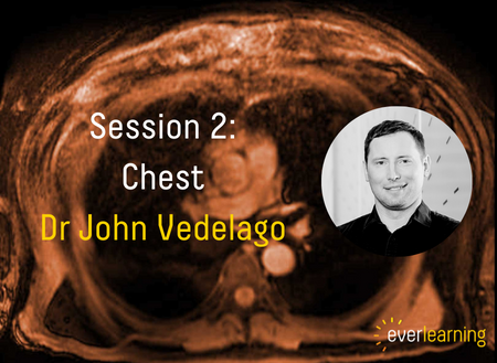 Chest hosted by Dr John Vedelago