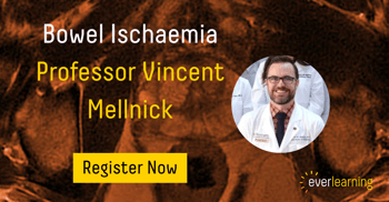 LinkedIn post everl;earning Bowel Ischaemia