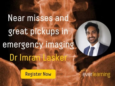Near misses and great pickups in emergency imaging (1)