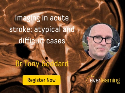 Imaging in acute stroke