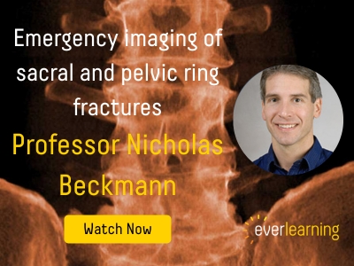 Emergency imaging of sacral and pelvic ring fractures (5)