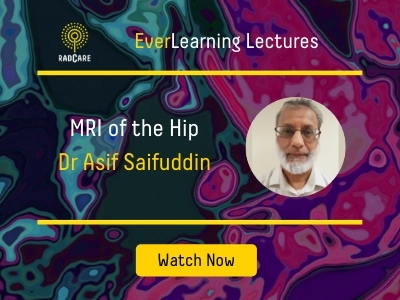 MRI of the hip Asif EL Lecture 400x300 resources page