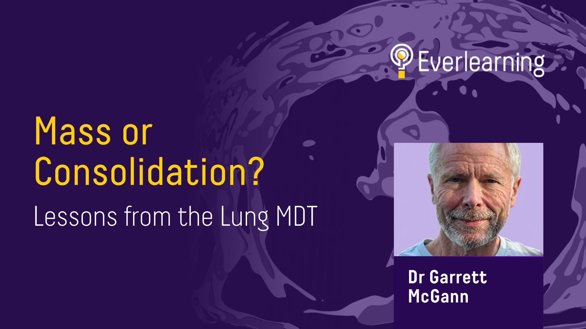 Mass or Consolidation Lessons from the Lung MDT