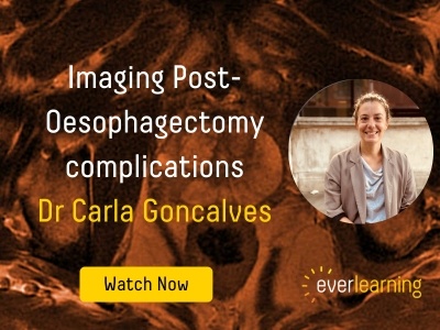 Imaging Post-Oesophagectomy complications (3)