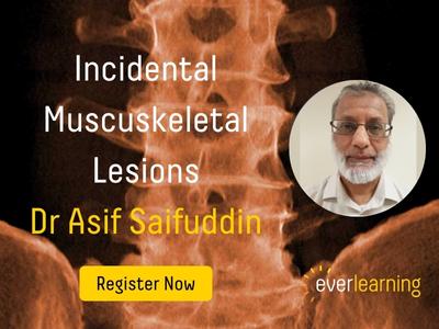 Incidental Musculoskeletal Lesions