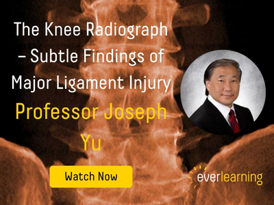 The Knee Radiograph – Subtle Findings of Major Ligament Injury (2)