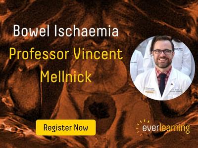 everlearning lecture - Bowel Ischaemia